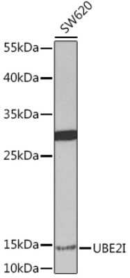 Western Blot: UBE2I/Ubc9 Antibody [NBP2-95142] - Western blot analysis of extracts of SW620 cells, using UBE2I/Ubc9 Rabbit pAb (NBP2-95142) at 1:1000 dilution. Secondary antibody: HRP Goat Anti-Rabbit IgG (H+L) at 1:10000 dilution. Lysates/proteins: 25ug per lane. Blocking buffer: 3% nonfat dry milk in TBST. Detection: ECL Basic Kit.